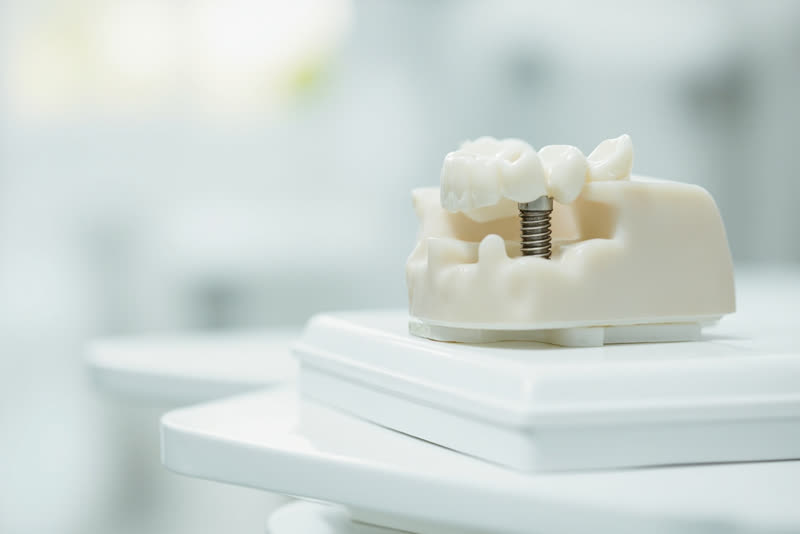 Implante dental