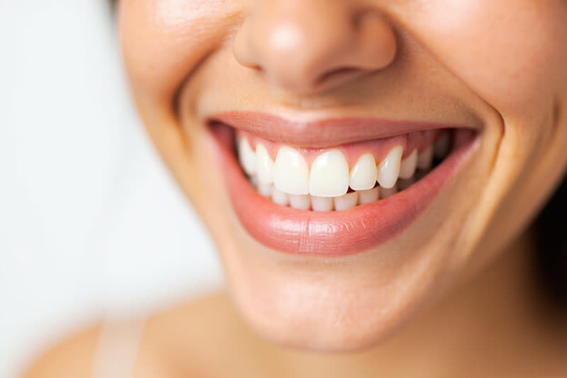Blanqueamiento dental